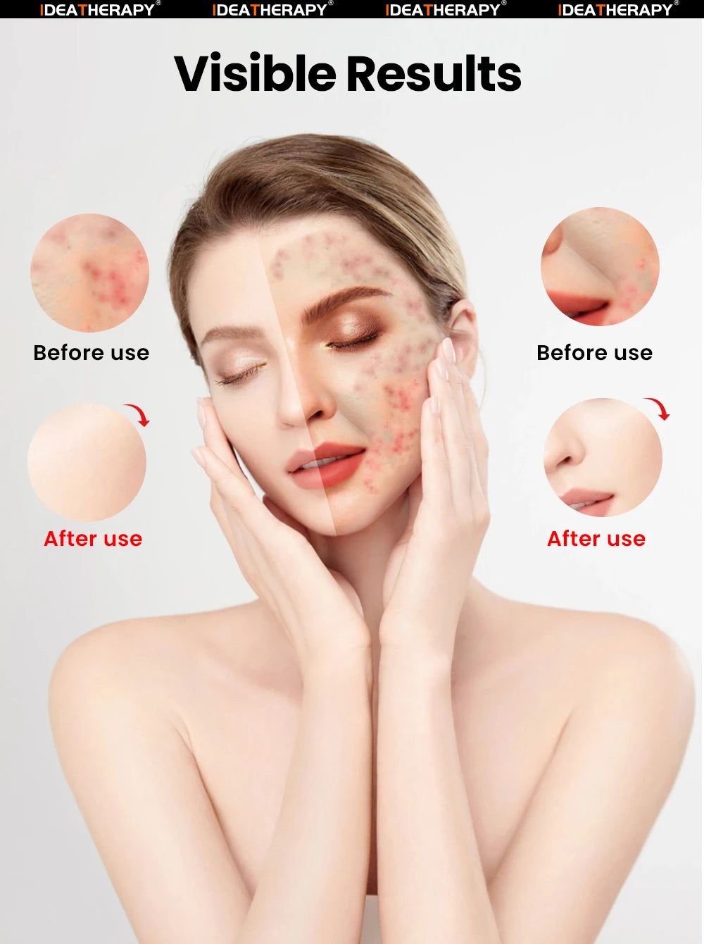 LED Face & Neck Mask – Red Light Therapy Beauty Mask 630nm, 415nm, 830nm for Skin Rejuvenation & Anti-Aging